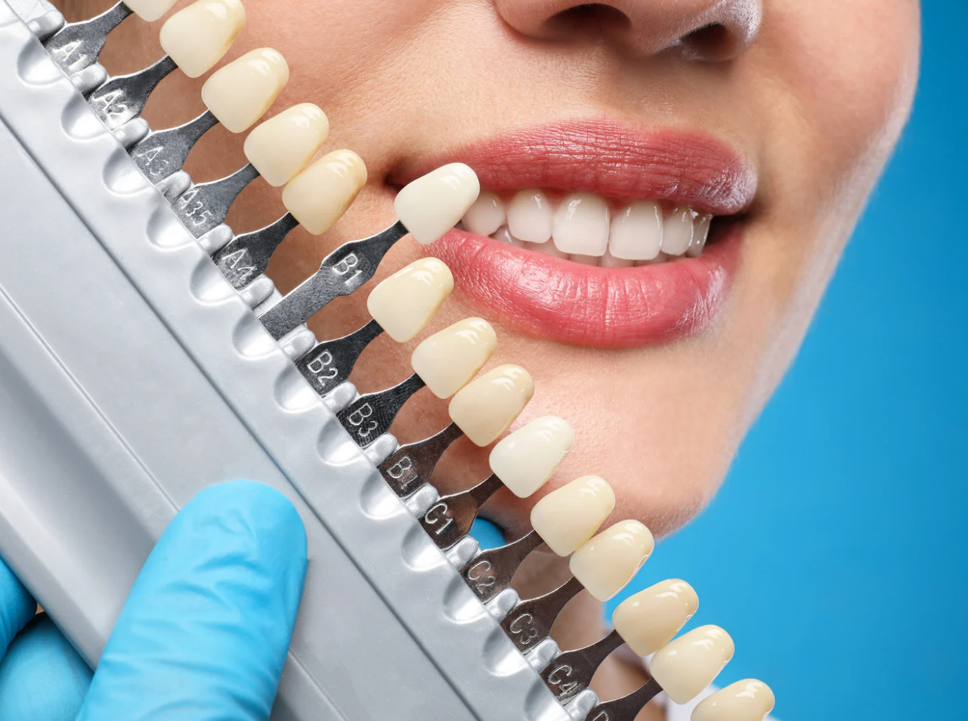 L’importanza della diagnosi precoce: Come VELscope può salvare il tuo sorriso